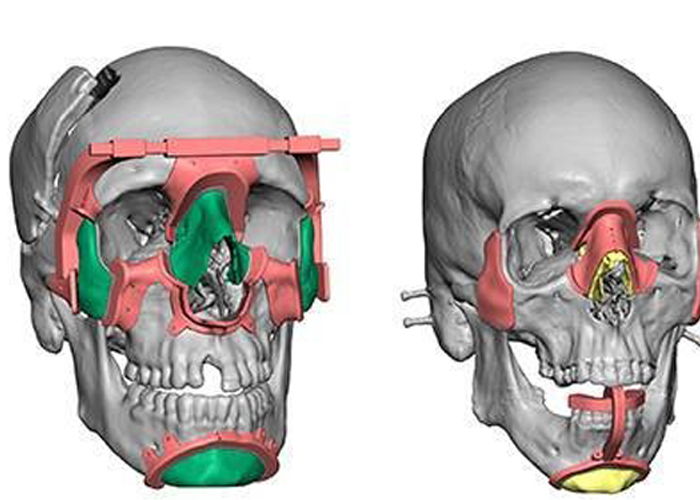 ����ȫ3D��ӡ���ϴ�����